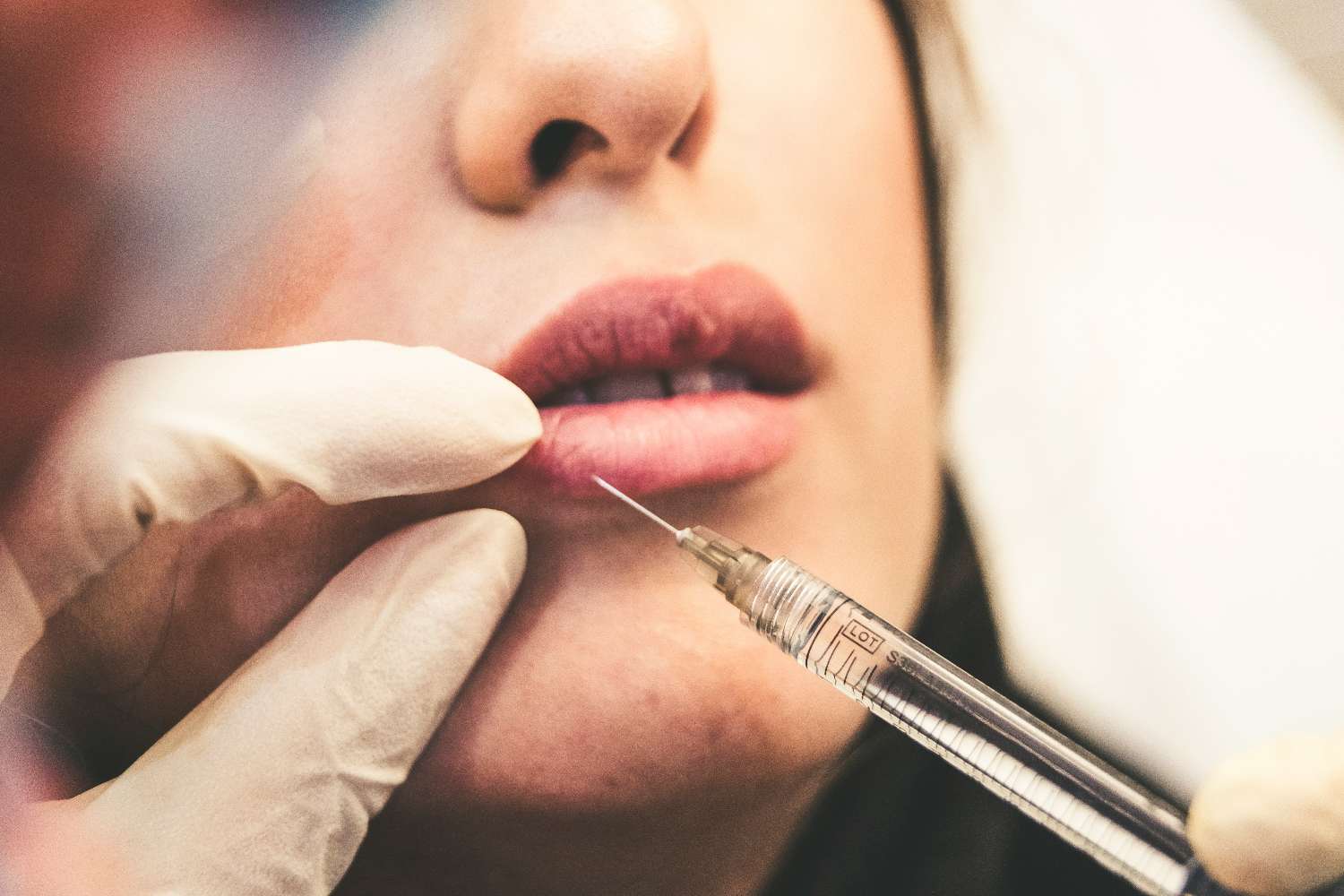 Botox: i benefici da conoscere